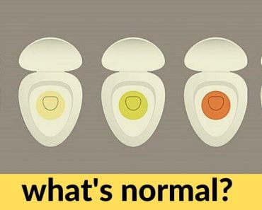 What The Color of Your Pee Says About You?