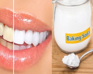 How to Whiten Teeth With Baking Soda
