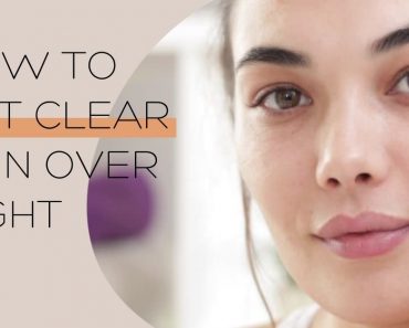 How to get clear skin overnight