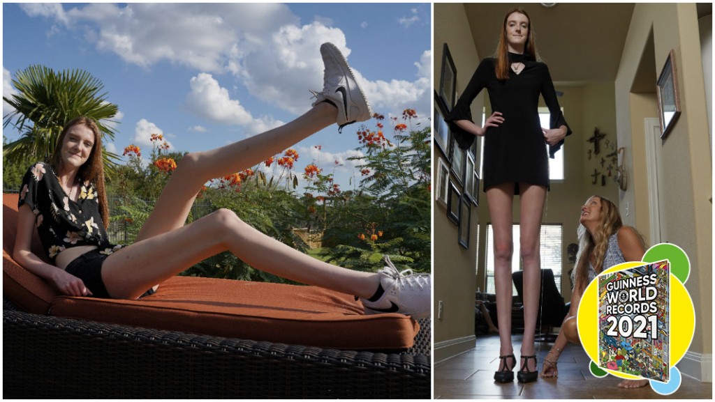 A teenager with the longest female legs