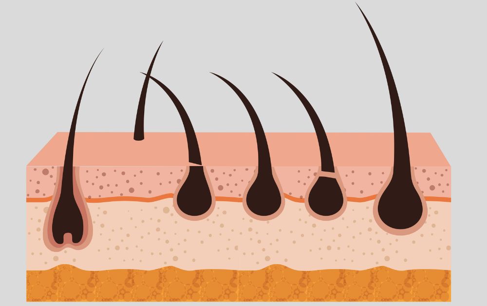 Why Your Hair Is Falling Out